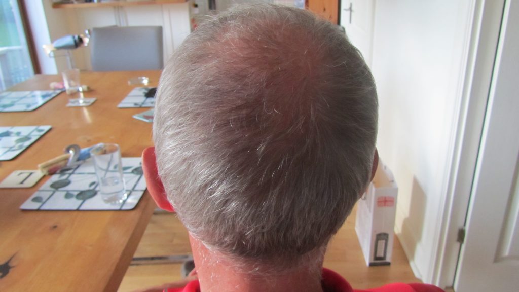 Grade 2/3 Hair